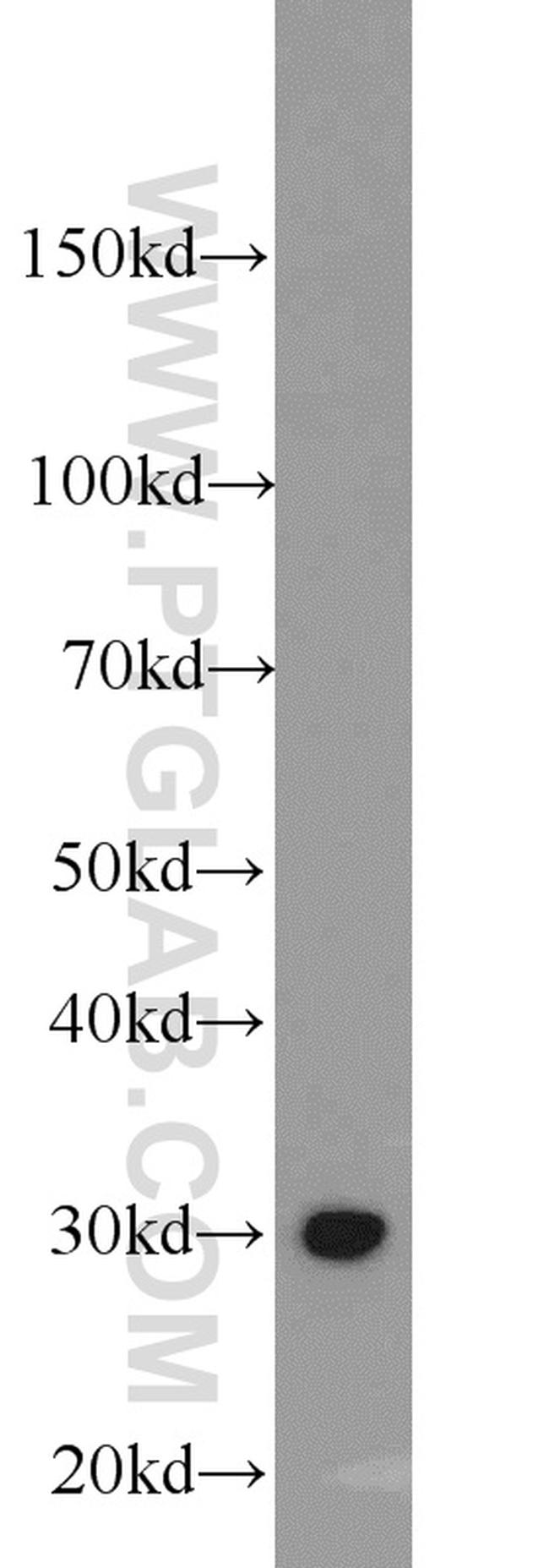 ING5 Antibody in Western Blot (WB)