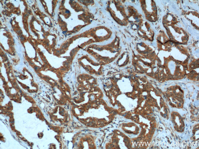 PMM2 Antibody in Immunohistochemistry (Paraffin) (IHC (P))