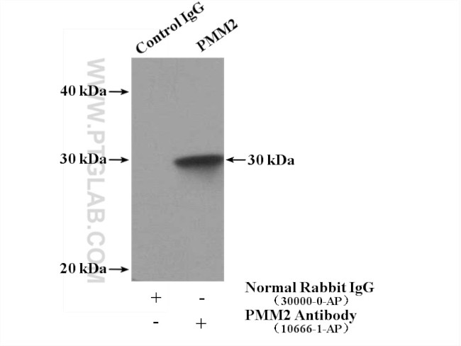 PMM2 Antibody in Immunoprecipitation (IP)