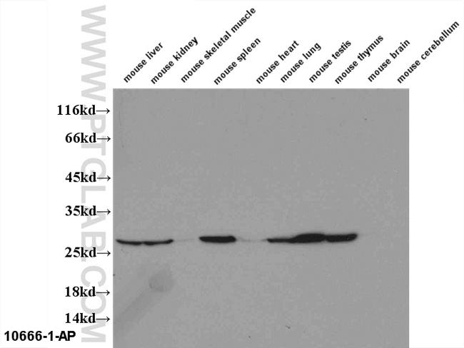 PMM2 Antibody in Western Blot (WB)