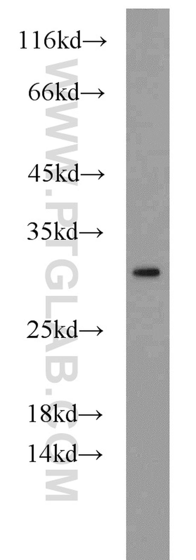 PMM2 Antibody in Western Blot (WB)