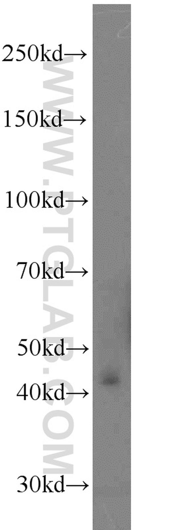 SCLY Antibody in Western Blot (WB)