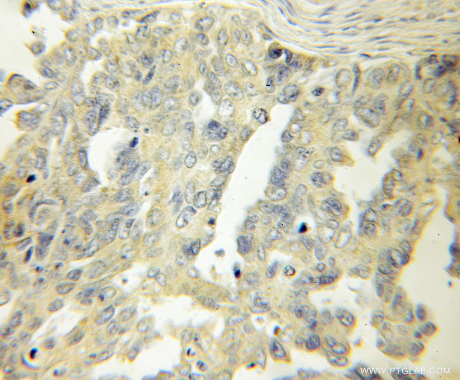 LAMR1/RPSA Antibody in Immunohistochemistry (Paraffin) (IHC (P))