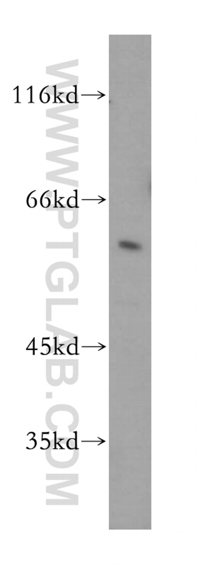 CARD9 Antibody in Western Blot (WB)