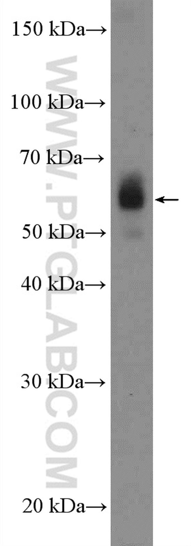 CARD9 Antibody in Western Blot (WB)