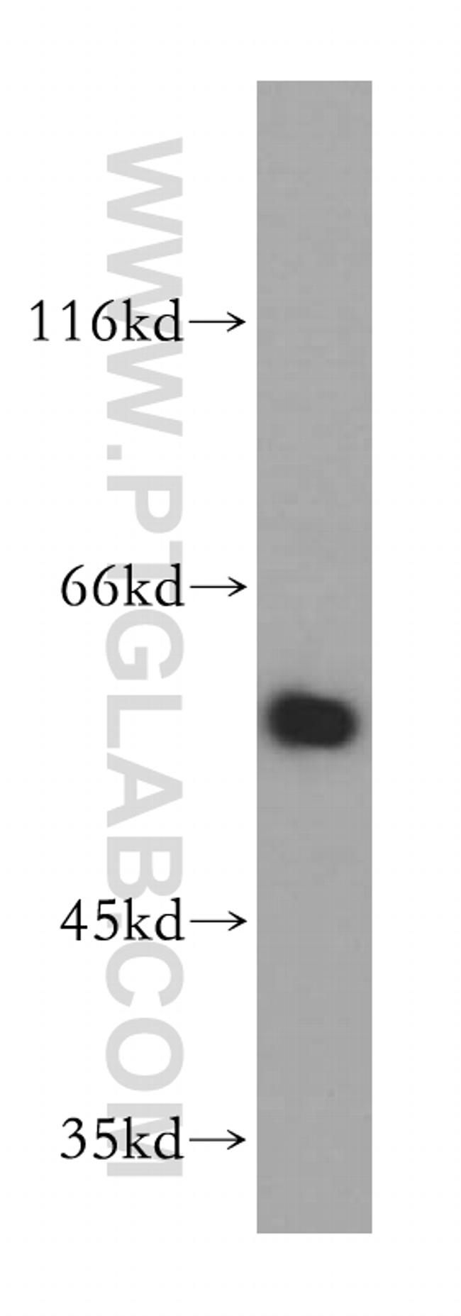 CARD9 Antibody in Western Blot (WB)