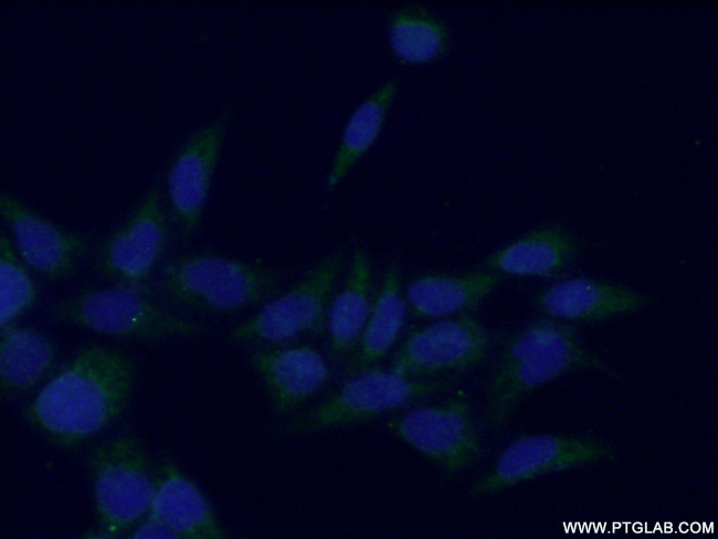 SPHK1 Antibody in Immunocytochemistry (ICC/IF)