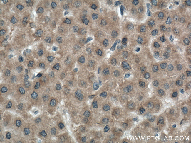 SPHK1 Antibody in Immunohistochemistry (Paraffin) (IHC (P))