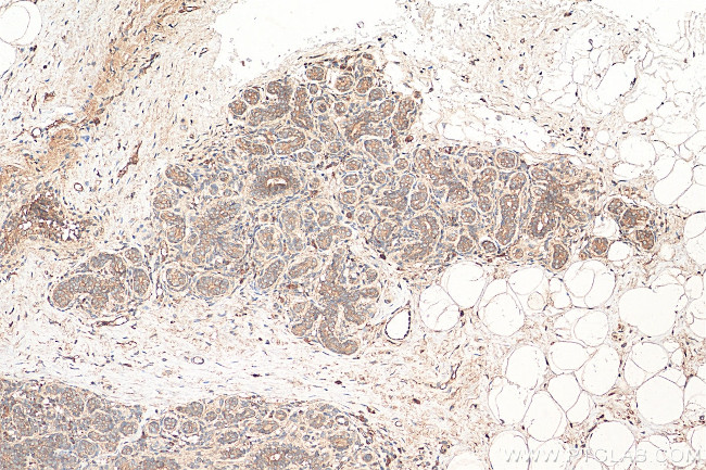 SPHK1 Antibody in Immunohistochemistry (Paraffin) (IHC (P))