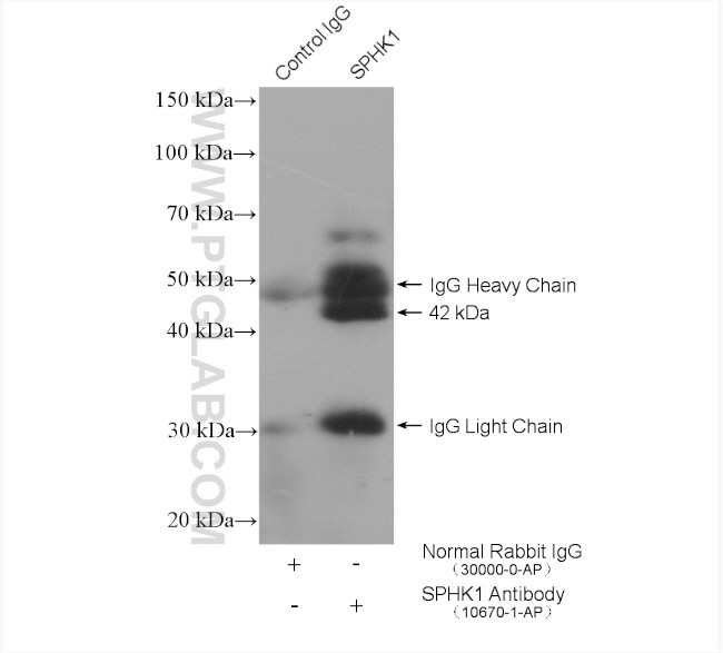 SPHK1 Antibody in Immunoprecipitation (IP)