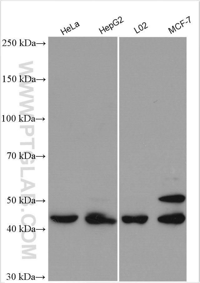 SPHK1 Antibody in Western Blot (WB)