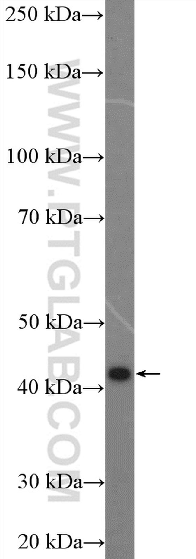 SPHK1 Antibody in Western Blot (WB)