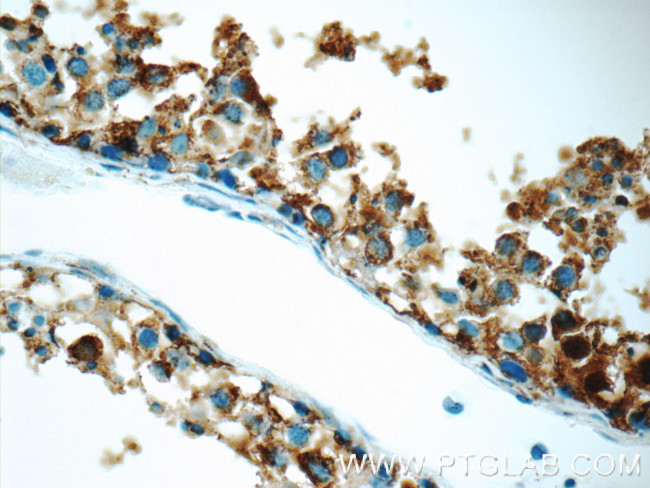 Protein C inhibitor Antibody in Immunohistochemistry (Paraffin) (IHC (P))