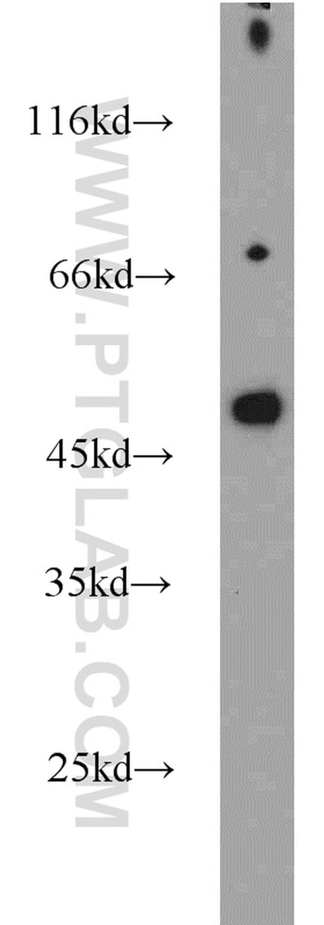 Protein C inhibitor Antibody in Western Blot (WB)