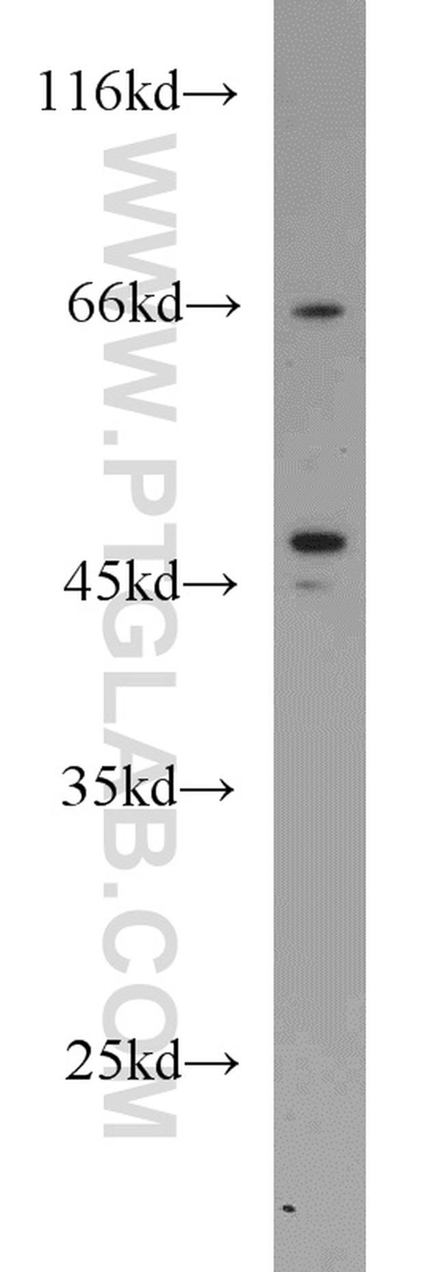 Protein C inhibitor Antibody in Western Blot (WB)