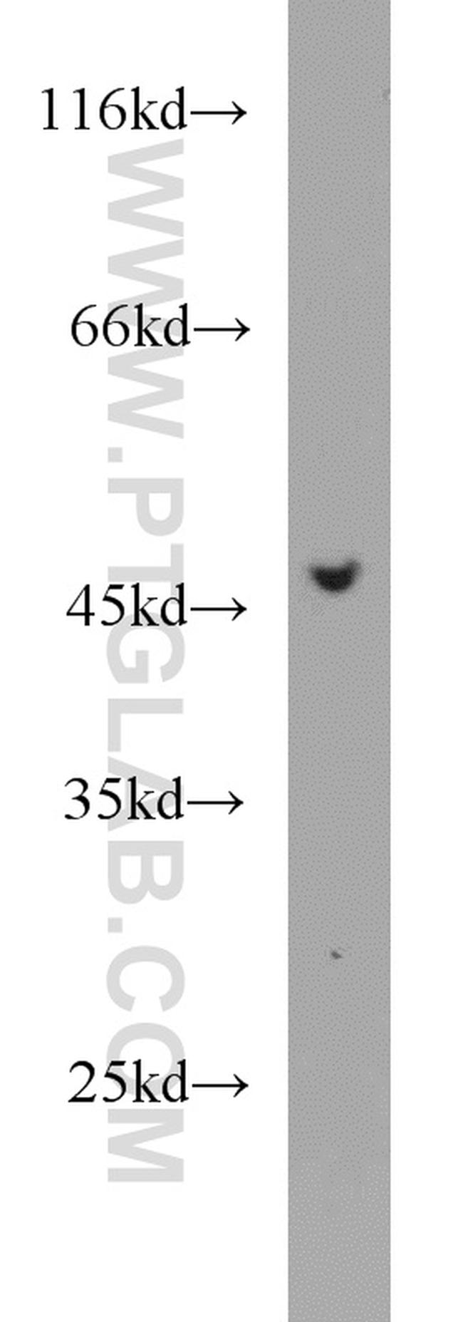 Protein C inhibitor Antibody in Western Blot (WB)