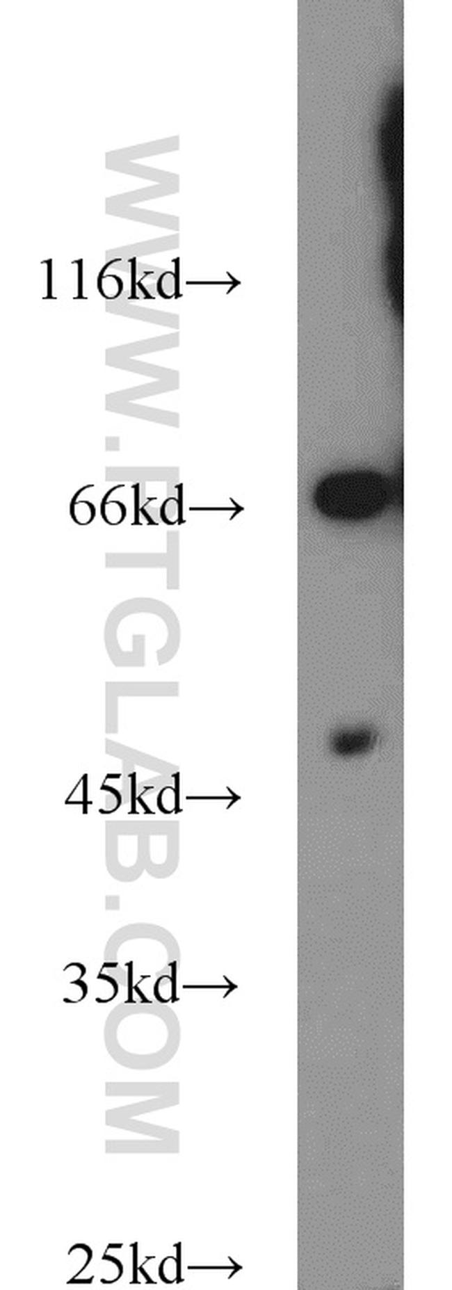 Protein C inhibitor Antibody in Western Blot (WB)