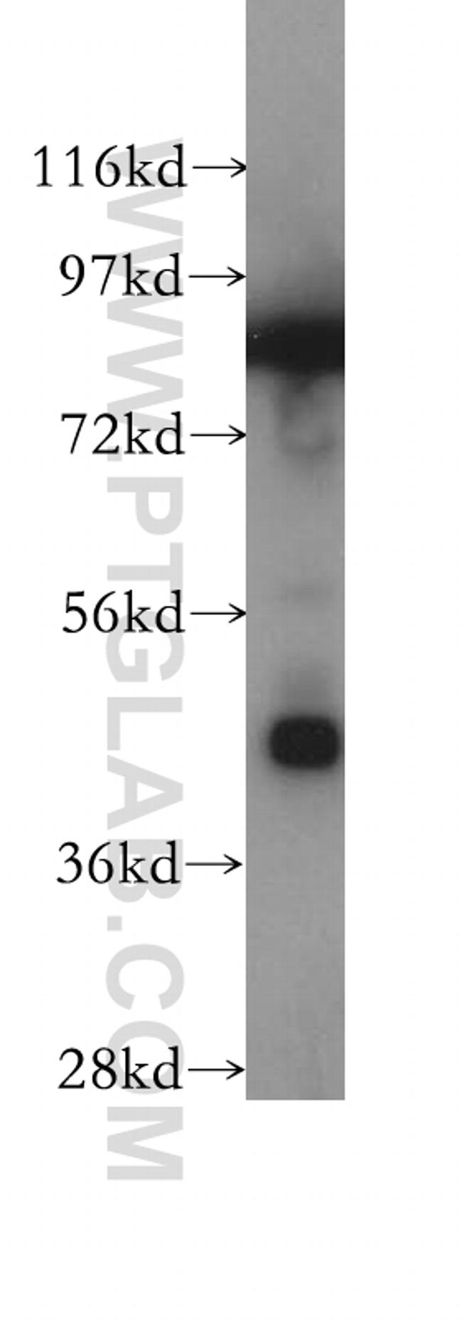 Protein C inhibitor Antibody in Western Blot (WB)