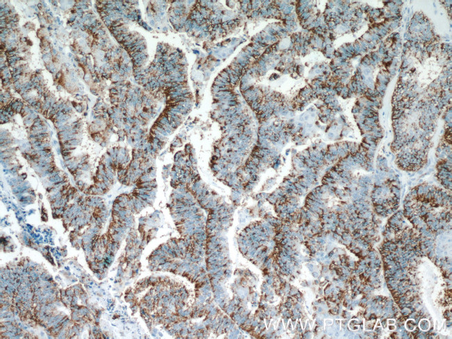 Protein C inhibitor Antibody in Immunohistochemistry (Paraffin) (IHC (P))