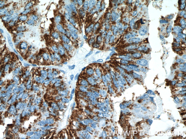 Protein C inhibitor Antibody in Immunohistochemistry (Paraffin) (IHC (P))