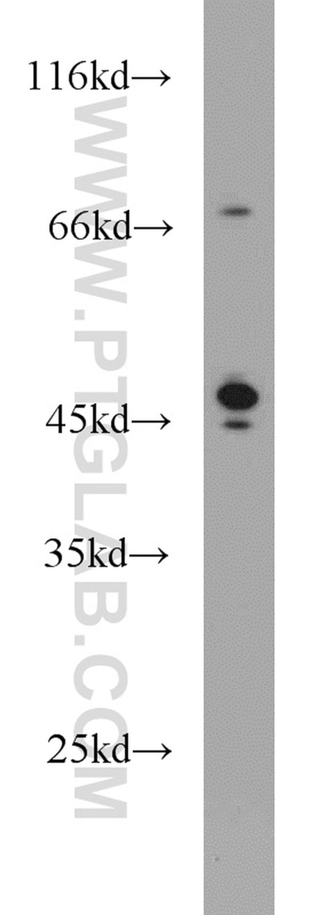 Protein C inhibitor Antibody in Western Blot (WB)