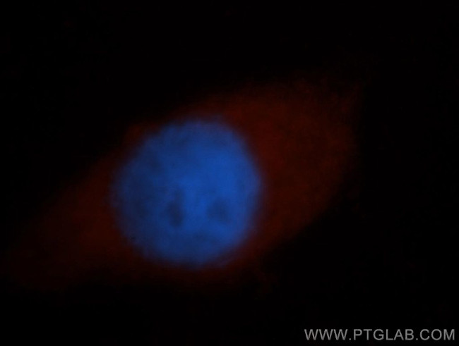 PAIP1 Antibody in Immunocytochemistry (ICC/IF)