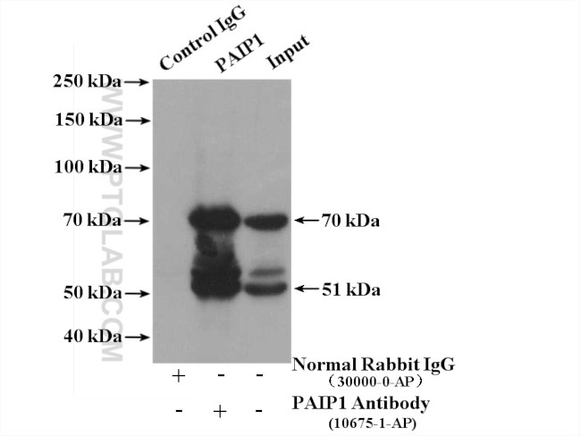 PAIP1 Antibody in Immunoprecipitation (IP)