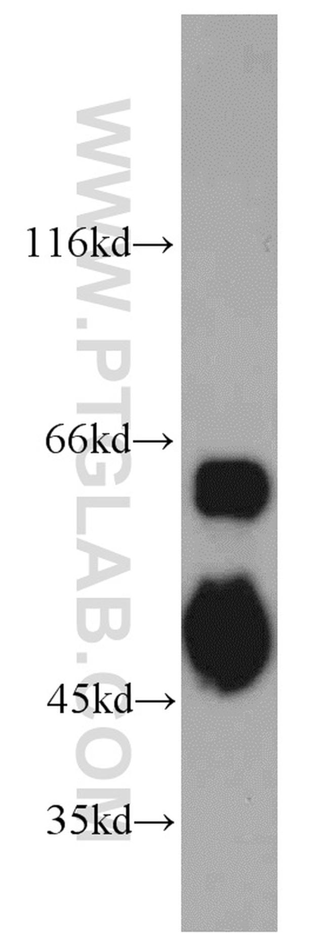 PAIP1 Antibody in Western Blot (WB)