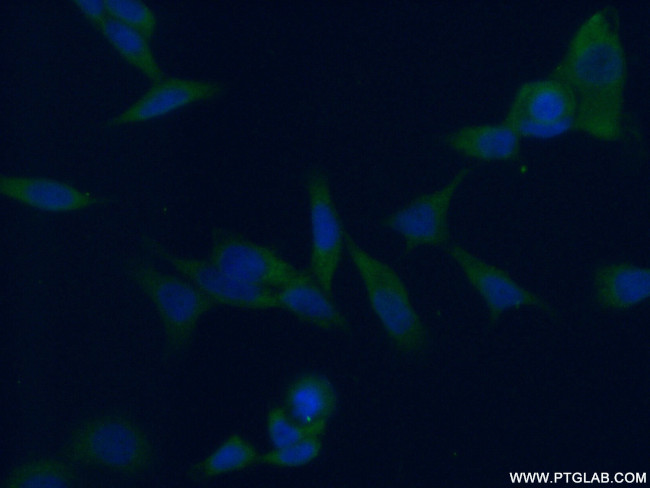 FABP3 Antibody in Immunocytochemistry (ICC/IF)