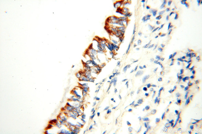 FABP3 Antibody in Immunohistochemistry (Paraffin) (IHC (P))