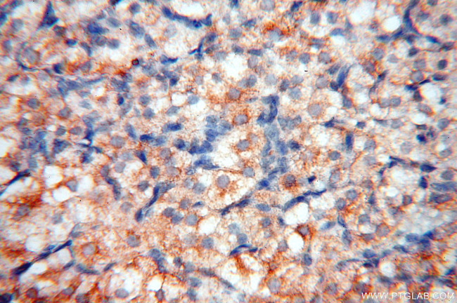 FABP3 Antibody in Immunohistochemistry (Paraffin) (IHC (P))