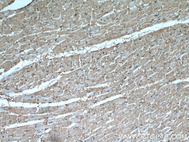 FABP3 Antibody in Immunohistochemistry (Paraffin) (IHC (P))