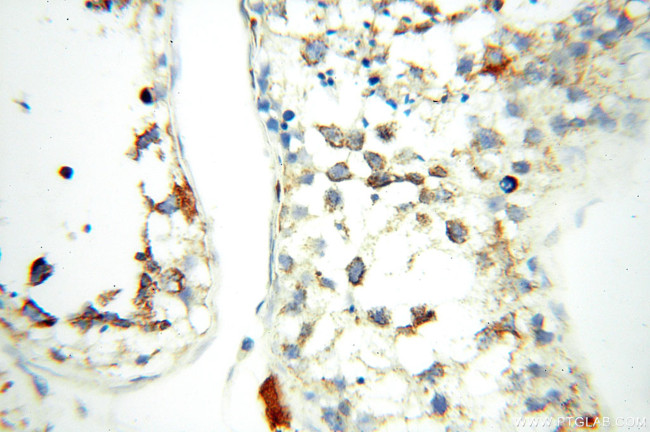 FABP3 Antibody in Immunohistochemistry (Paraffin) (IHC (P))