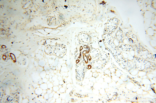 FABP3 Antibody in Immunohistochemistry (Paraffin) (IHC (P))