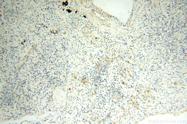 FABP3 Antibody in Immunohistochemistry (Paraffin) (IHC (P))