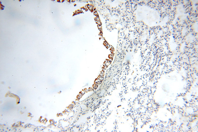 FABP3 Antibody in Immunohistochemistry (Paraffin) (IHC (P))