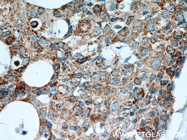 FABP3 Antibody in Immunohistochemistry (Paraffin) (IHC (P))