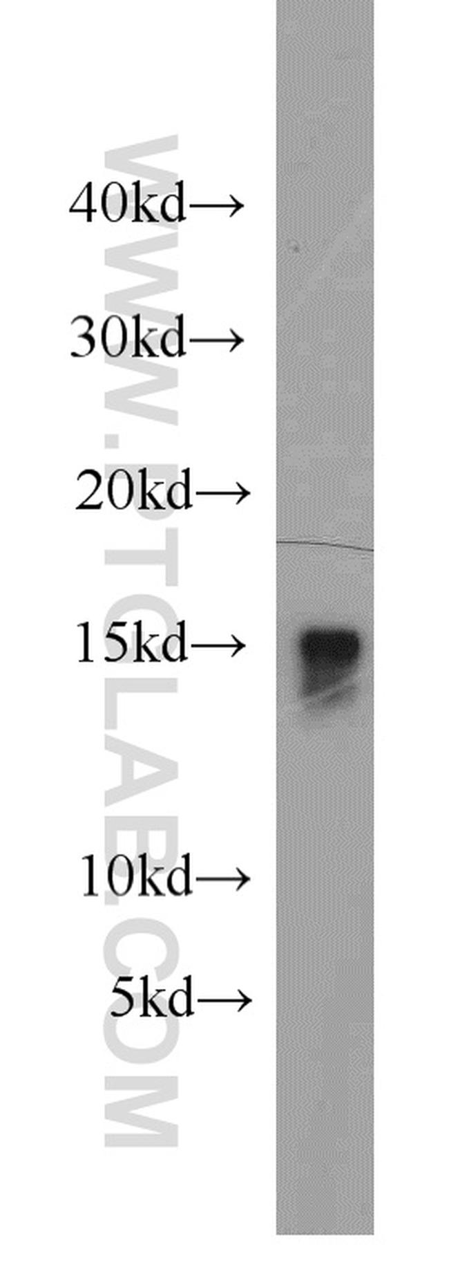 FABP3 Antibody in Western Blot (WB)