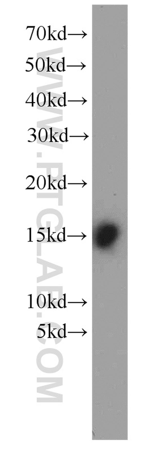 FABP3 Antibody in Western Blot (WB)