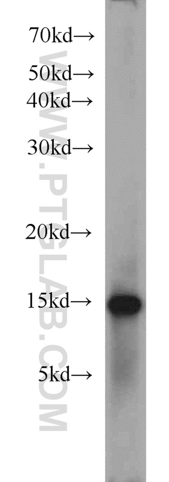 FABP3 Antibody in Western Blot (WB)