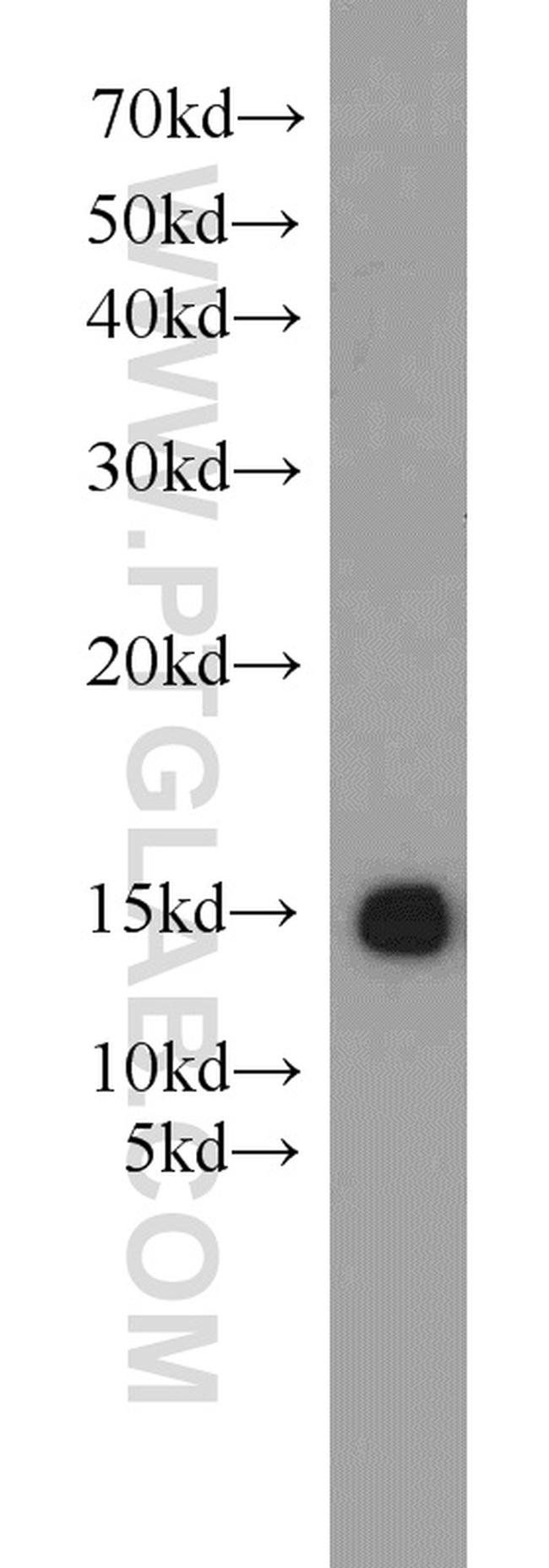 FABP3 Antibody in Western Blot (WB)