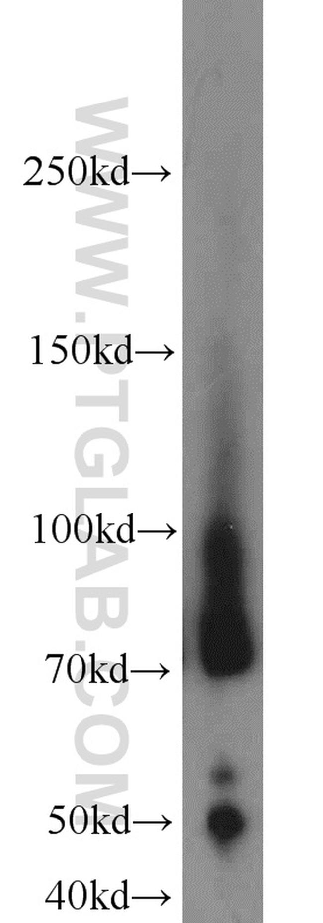 Lumican Antibody in Western Blot (WB)