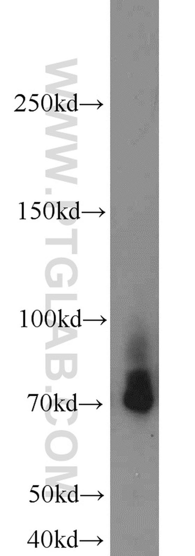 Lumican Antibody in Western Blot (WB)