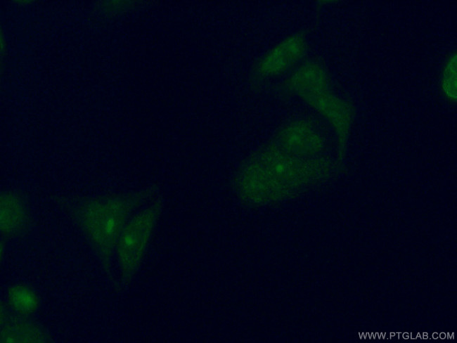 RGS2 Antibody in Immunocytochemistry (ICC/IF)