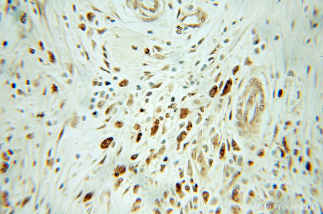 RGS2 Antibody in Immunohistochemistry (Paraffin) (IHC (P))