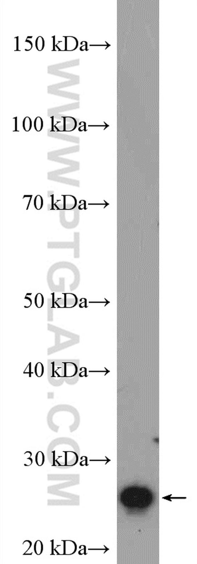 RGS2 Antibody in Western Blot (WB)