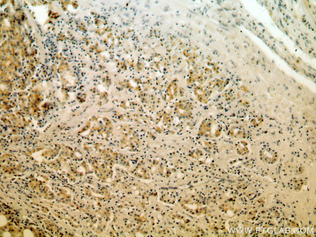 KLK3/PSA Antibody in Immunohistochemistry (Paraffin) (IHC (P))