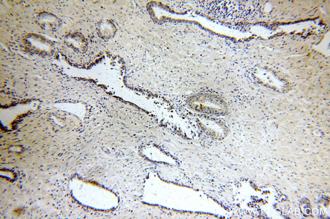 KLK3/PSA Antibody in Immunohistochemistry (Paraffin) (IHC (P))