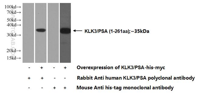 KLK3/PSA Antibody in Western Blot (WB)