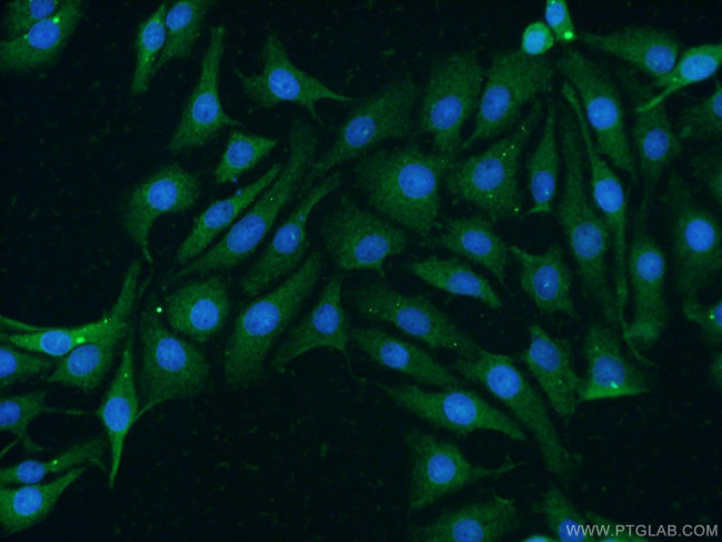 TNFSF13 Antibody in Immunocytochemistry (ICC/IF)